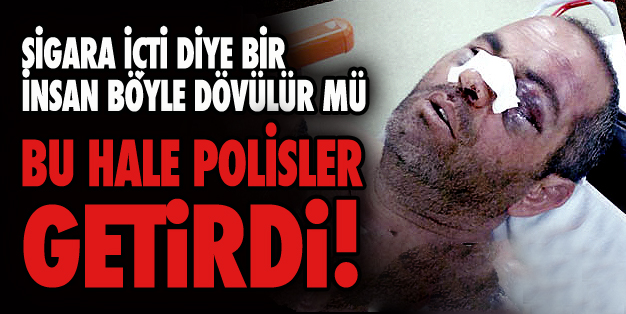 SİGARA İÇTİ, PARA CEZASI YERİNE ÖLDÜRESİYE DÖVÜLDÜ